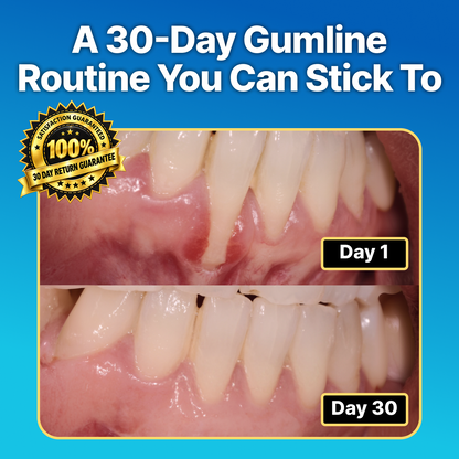 ORAVEXA GumRenew™ Intensive Gum Serum Ampoules